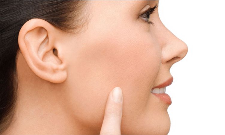 Cirugía de Bichectomía