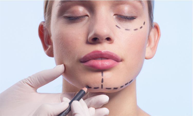 Mentoplastia en Lima