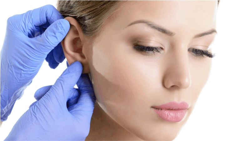 Cirugía de Otoplastia en Lima